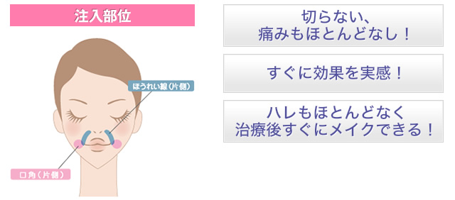 切らない、痛みもほとんどなし！すぐに効果を実感！！ハレもほとんどなく治療後すぐにメイクできる！